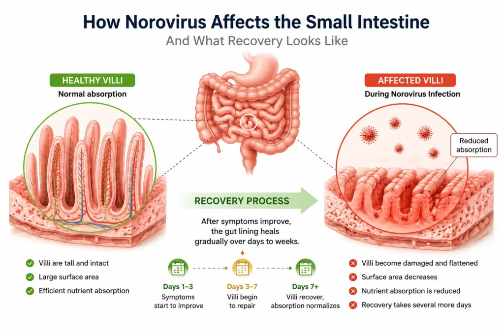 Small intestine villi affected during norovirus infection and recovery process